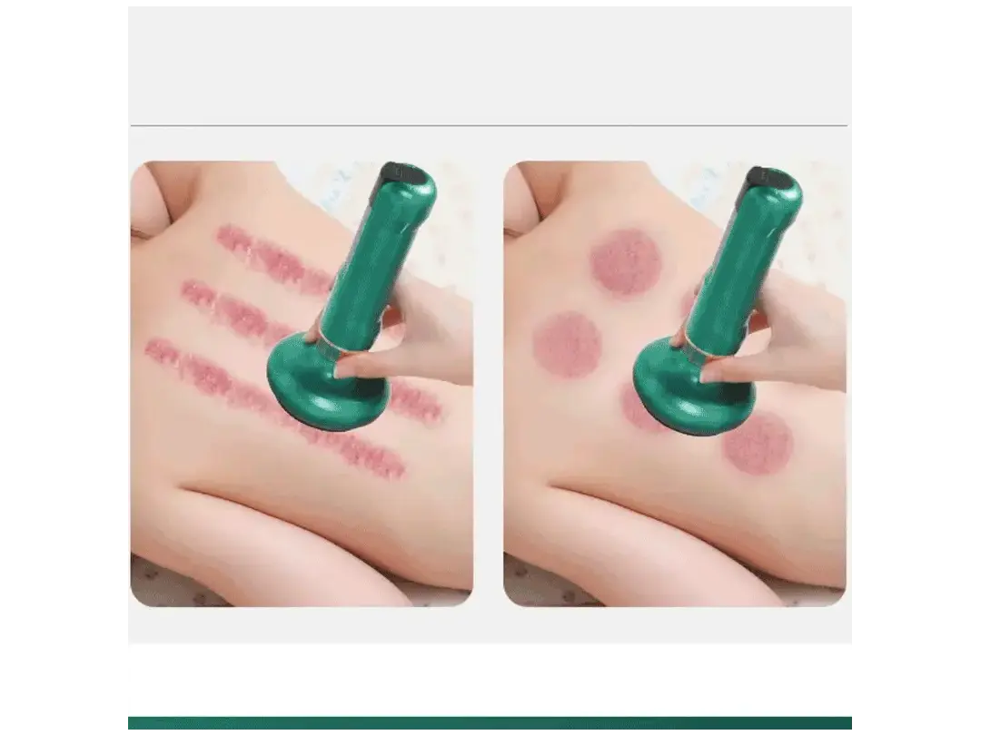 CeluliGone® / Ventosa Eléctrica Para Celulitis