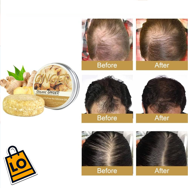 SHAMPOO GINGER PARA CRECIMIENTO