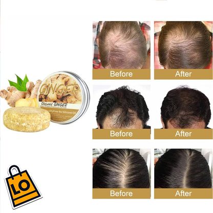 SHAMPOO GINGER PARA CRECIMIENTO