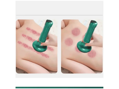 CeluliGone® / Ventosa Eléctrica Para Celulitis